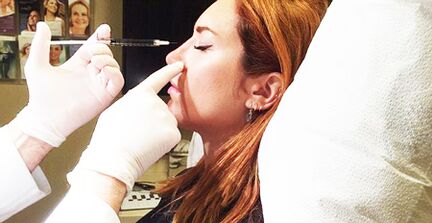 Procedemento de rinoplastia mediante recheos