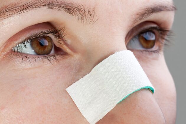 posibles complicacións no período postoperatorio de corrección do tabique nasal
