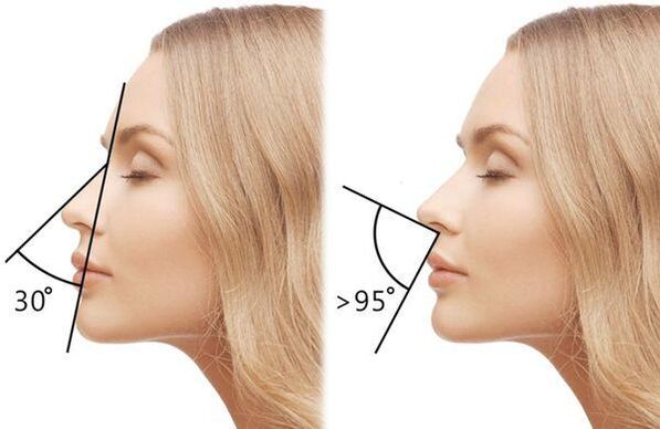 medición do ángulo do nariz